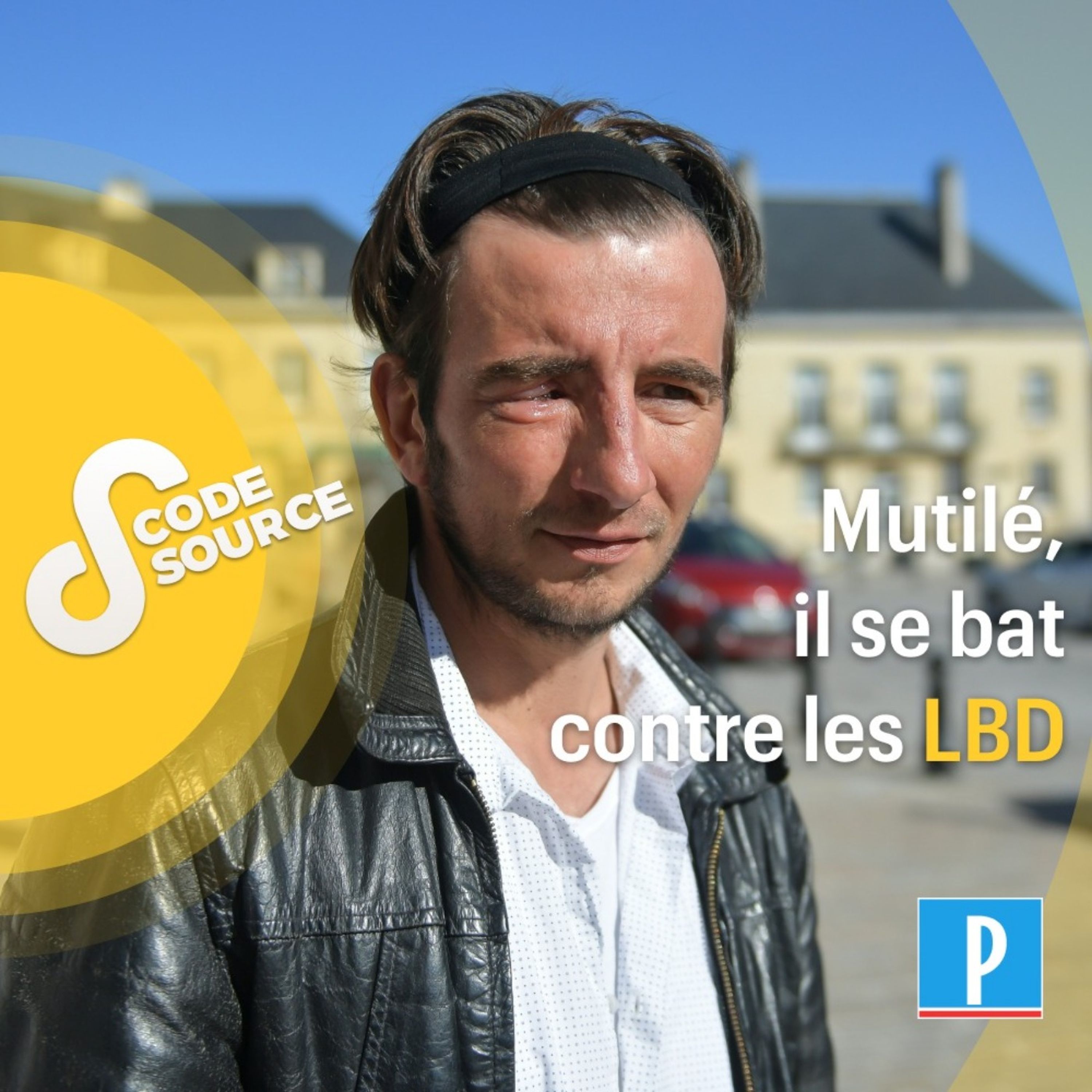 Mutilé, il se bat contre les LBD