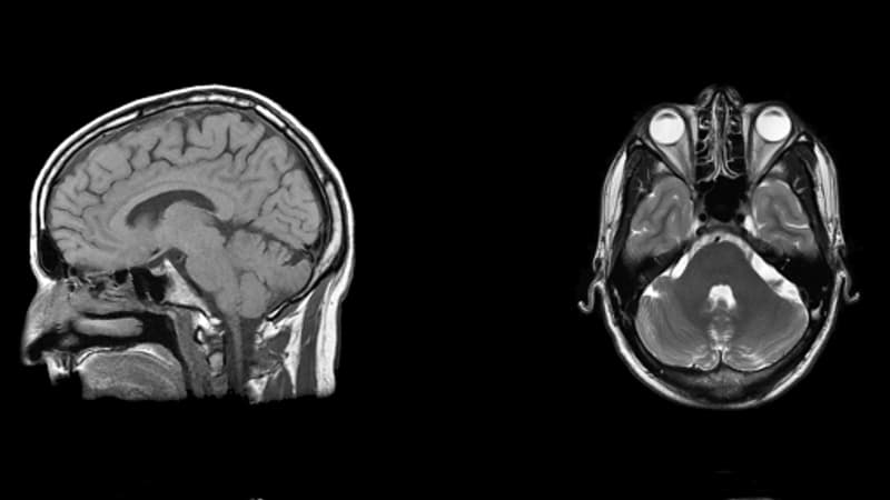 Pourquoi utilisons-nous bien plus que seulement 10% des capacités de notre cerveau