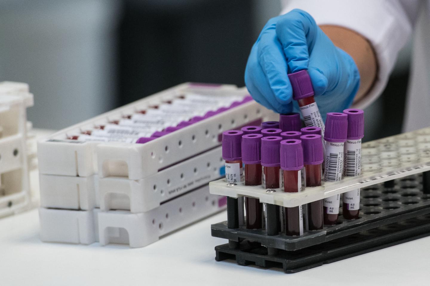 Les laboratoires d???analyses médicales, en grève pour quatre jours, promettent un mouvement...