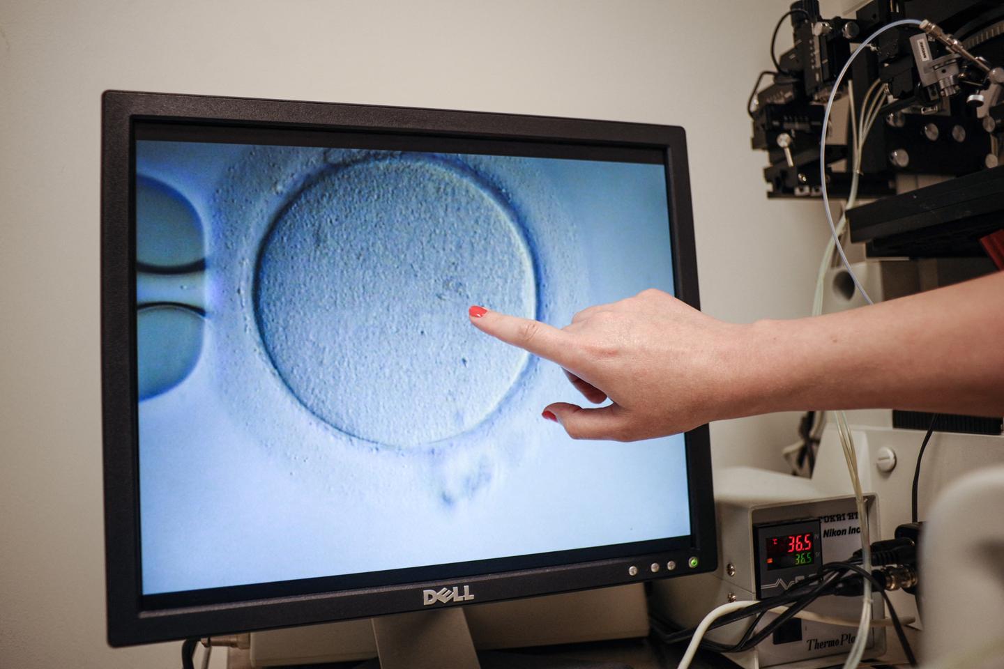 Dans les entreprises américaines, le gel des ovocytes est proposé aux salariées comme un nouvel...