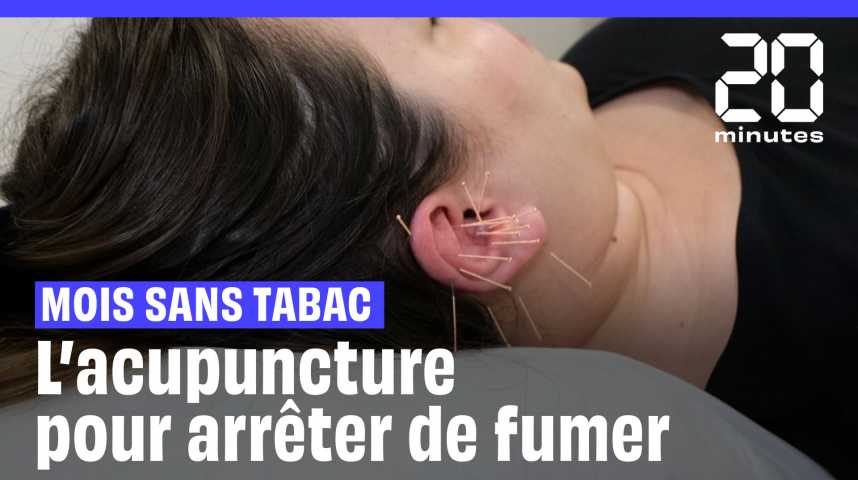 Mois sans tabac : Et l???acupuncture dans l???oreille pour arrêter de fumer, ça marche vraiment...