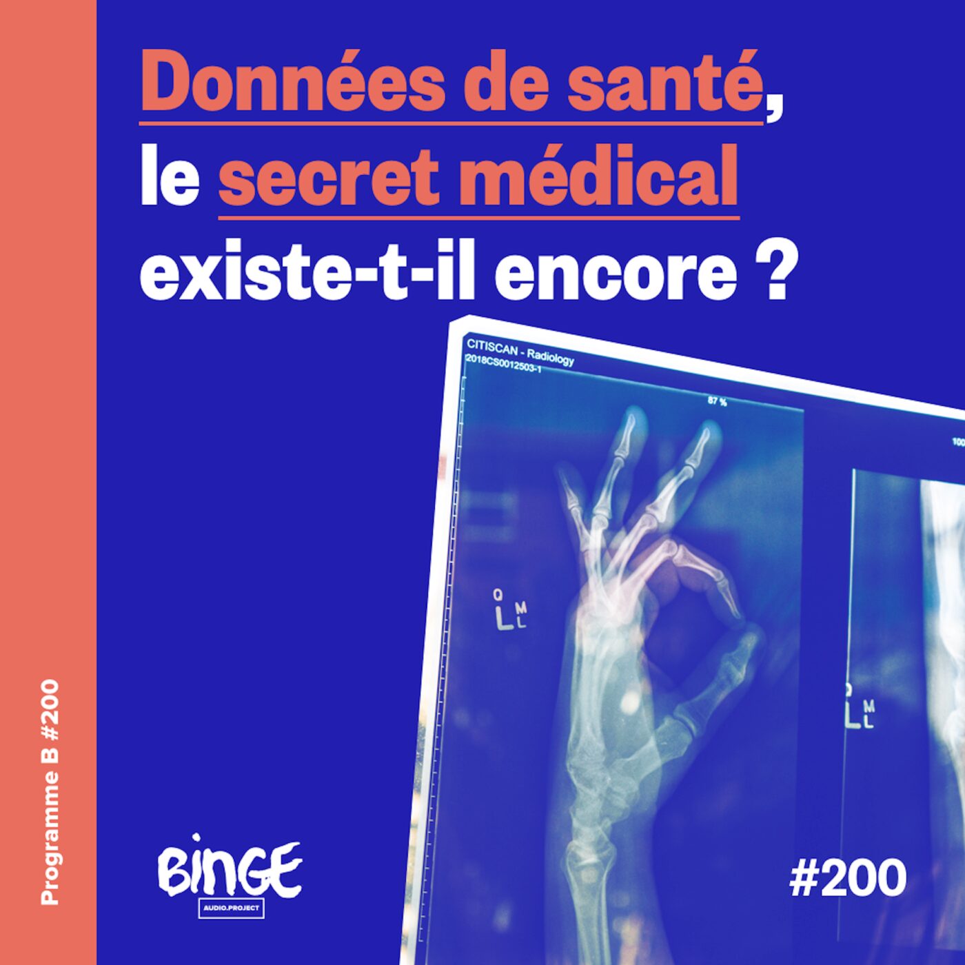 Données de santé, le secret médical existe-t-il encore ?