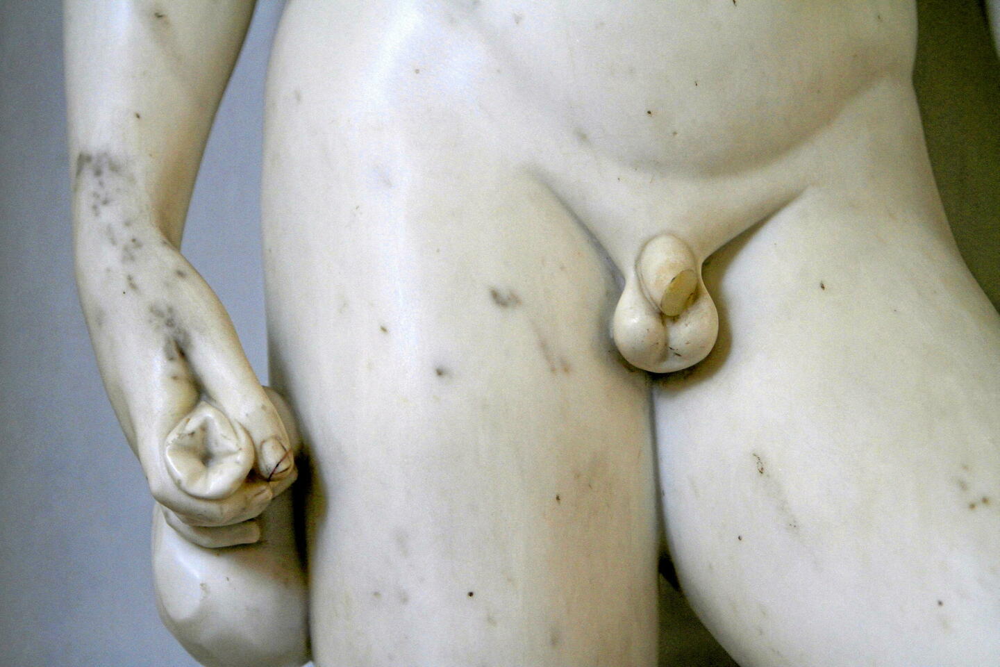 Les fractures du pénis sont-elles (vraiment) plus nombreuses à Noël ?