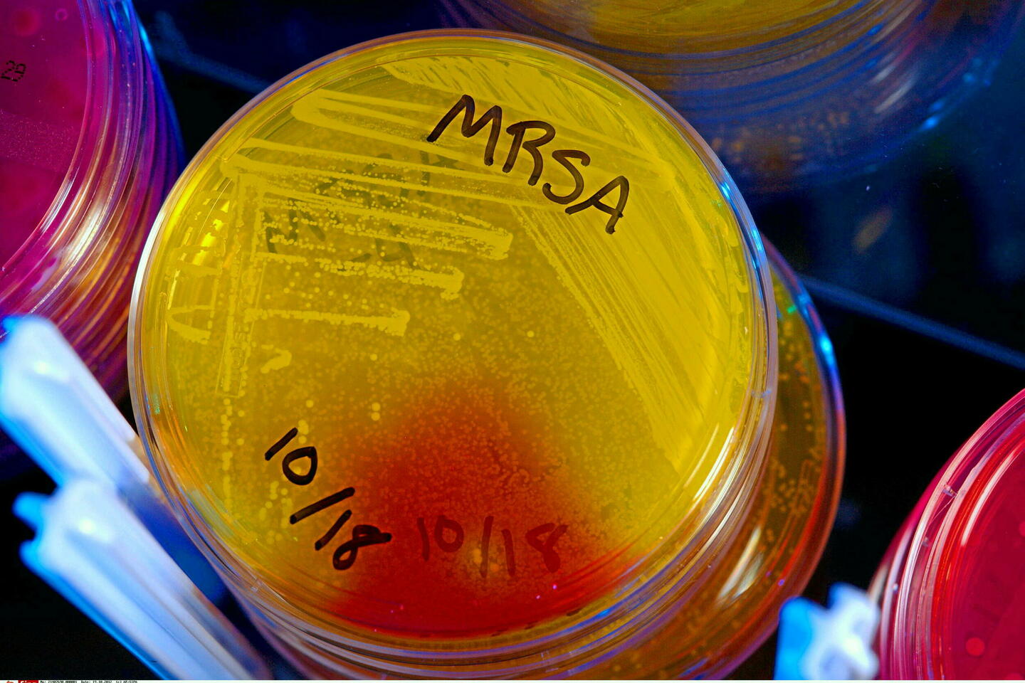 Découverte d???un superantibiotique contre les bactéries tueuses