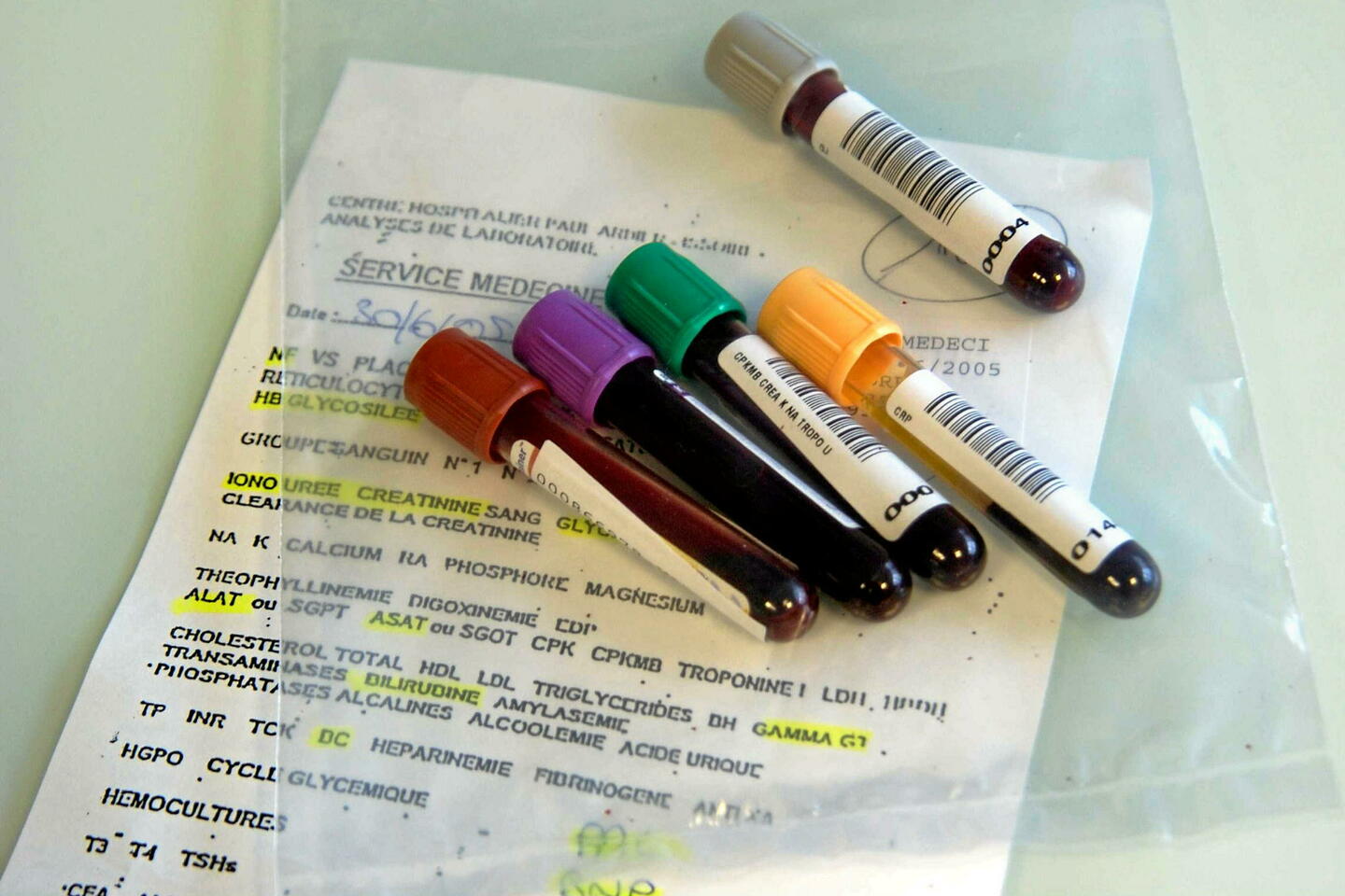 Comment bien interpréter ses résultats d???analyses de sang