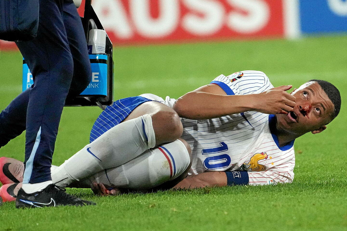 Euro de football : Mbappé pourra-t-il jouer contre les Pays-Bas avec son nez cassé ?