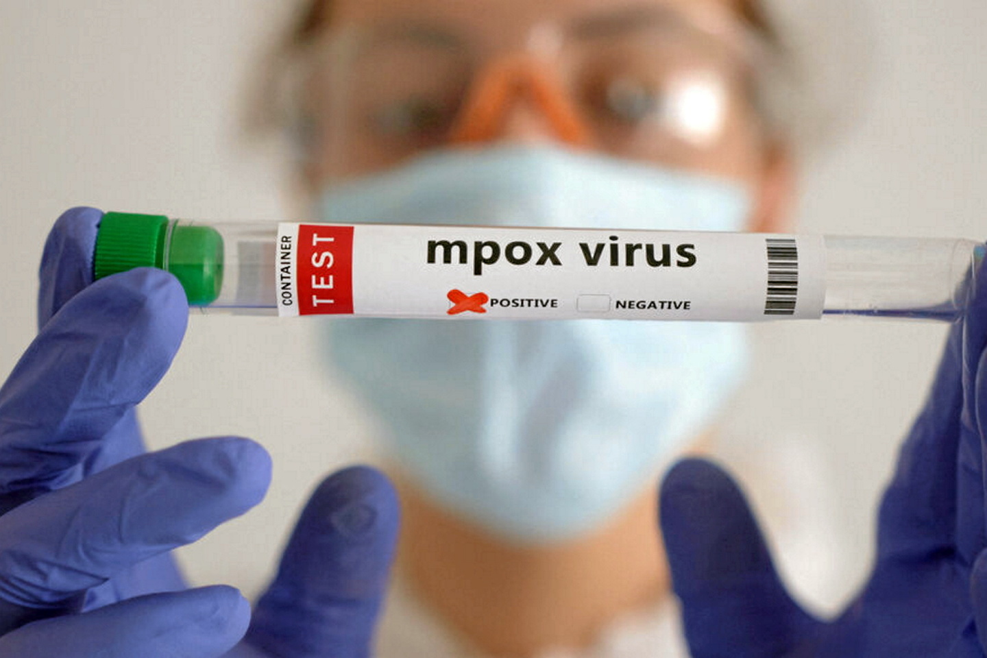 Métapneumovirus humain : faut-il vraiment s’inquiéter de la flambée de cas en Chine ?